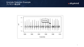 Anomaly Detection Example
アノマリー検出例
6
 
