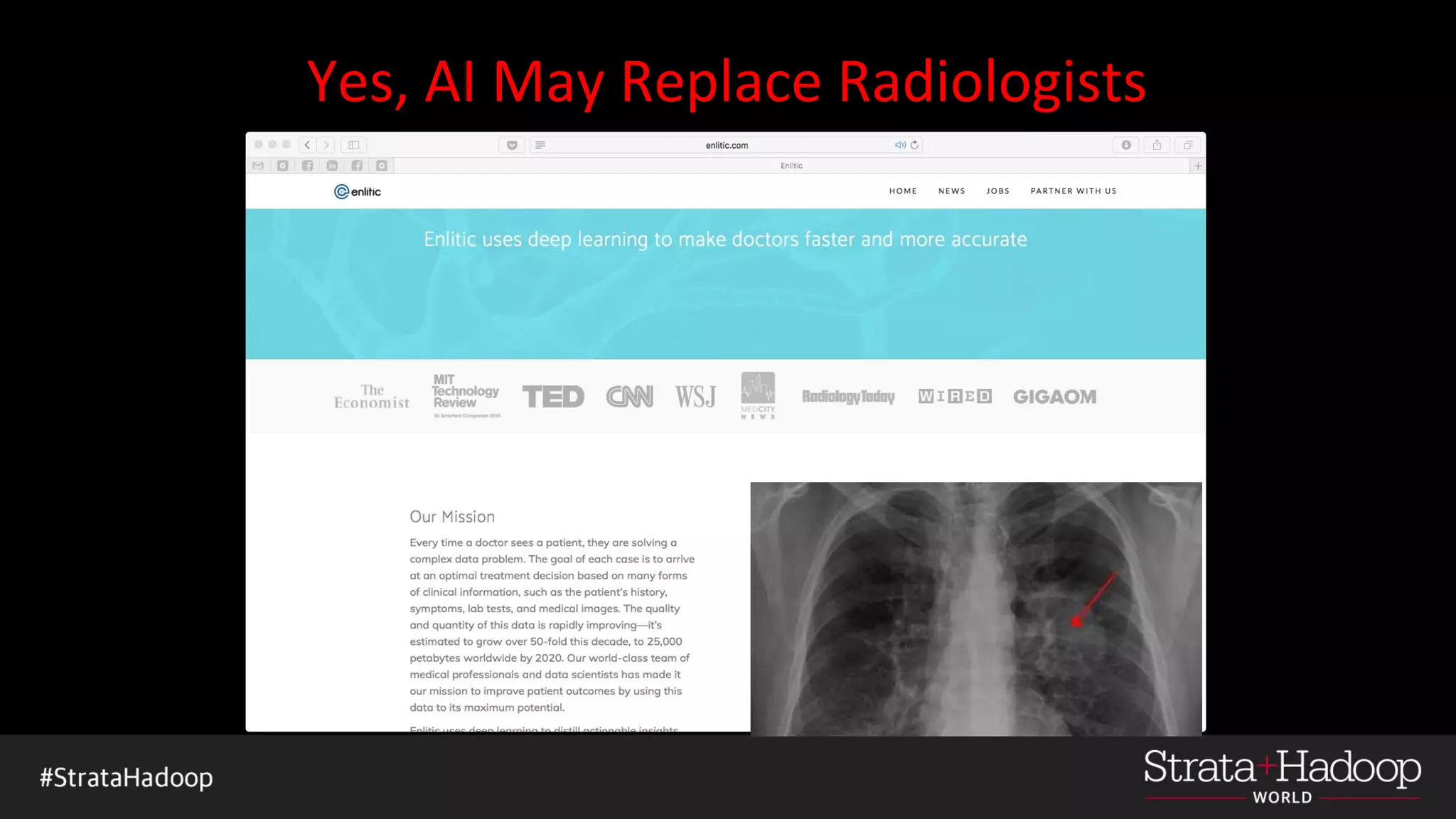 Yes, AI May Replace Radiologists
 
