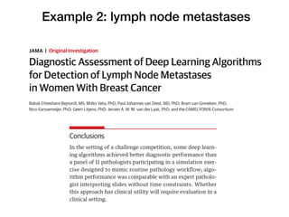 Example 2: lymph node metastases
 