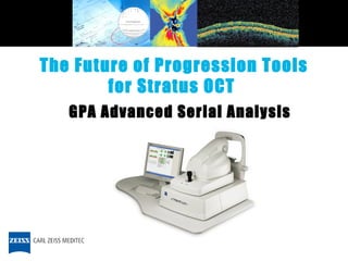 The Future of Progression Tools for Stratus OCT  GPA Advanced Serial Analysis 