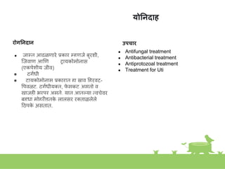 योननदाि
रोगननदान
● जास्त्त आढळणारे प्रकार म्हणजे बुरिी,
स्त्जवाणू आणण िायकोमोिास
(एकपेिीय जीव)
● दुगांधी
● िायकोमोिास प्रकारात हा स्राव हहरवट-
वपवळट, दुगांधीयुक्त, फ
े सकट असतो व
खाजही भरपूर असते. यात आतल्या तवचेवर
बहुधा मोहरीइतक
े लालसर रक्ताळलेले
हठपक
े असतात.
उपचार
● Antifungal treatment
● Antibacterial treatment
● Antiprotozoal treatment
● Treatment for Uti
 