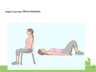 Kegels Exercises (ककगल एक्सरसाइज)
36
 