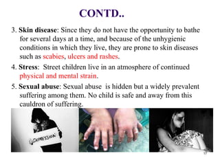 CONTD..
3. Skin disease: Since they do not have the opportunity to bathe
for several days at a time, and because of the unhygienic
conditions in which they live, they are prone to skin diseases
such as scabies, ulcers and rashes.
4. Stress: Street children live in an atmosphere of continued
physical and mental strain.
5. Sexual abuse: Sexual abuse is hidden but a widely prevalent
suffering among them. No child is safe and away from this
cauldron of suffering.
17
 