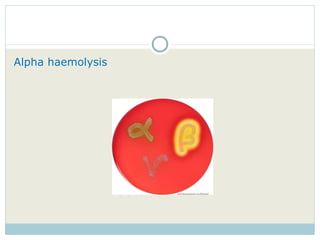 Alpha haemolysis 