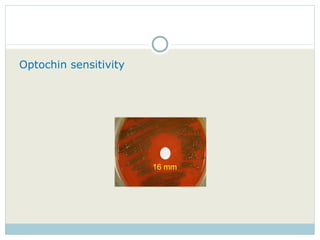 Optochin sensitivity   16 mm 