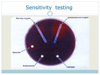Sensitivity  testing  