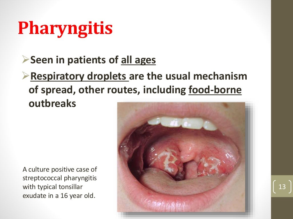 Streptococcal infections