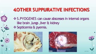 4.OTHER SUPPURATIVE INFECTIONS
S.PYOGENES can cause abscesses in internal organs
like brain ,lungs ,liver & kidney
Septicemia & pyemia.
08-07-2015 28
 
