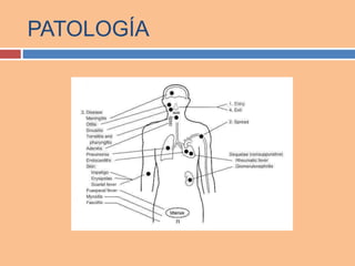 PATOLOGÍA
 