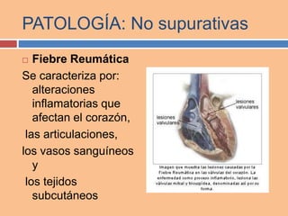 PATOLOGÍA: No supurativas
 Fiebre Reumática
Se caracteriza por:
alteraciones
inflamatorias que
afectan el corazón,
las articulaciones,
los vasos sanguíneos
y
los tejidos
subcutáneos
 