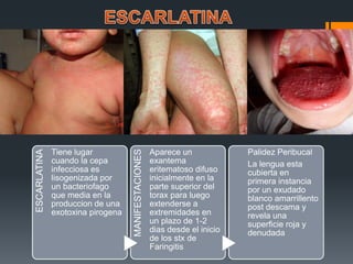 ESCARLATINA
Tiene lugar
cuando la cepa
infecciosa es
lisogenizada por
un bacteriofago
que media en la
produccion de una
exotoxina pirogena
MANIFESTACIONES
Aparece un
exantema
eritematoso difuso
inicialmente en la
parte superior del
torax para luego
extenderse a
extremidades en
un plazo de 1-2
dias desde el inicio
de los stx de
Faringitis
Palidez Peribucal
La lengua esta
cubierta en
primera instancia
por un exudado
blanco amarrillento
post descama y
revela una
superficie roja y
denudada
 