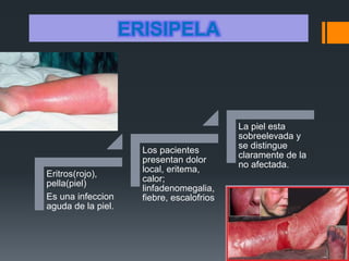 ERISIPELA
Eritros(rojo),
pella(piel)
Es una infeccion
aguda de la piel.
Los pacientes
presentan dolor
local, eritema,
calor;
linfadenomegalia,
fiebre, escalofrios
La piel esta
sobreelevada y
se distingue
claramente de la
no afectada.
 