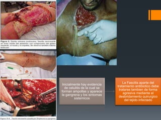 Inicialmente hay evidencia
de celulitis de la cual se
forman ampollas y aparece
la gangrena y los sintomas
sistemicos
La Fascitis aparte del
tratamiento antibiotico debe
tratarse tambien de forma
agresiva mediante el
desbridamiento quirurgico
del tejido infectado
 