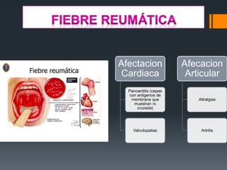 Afectacion
Cardiaca
Pancarditis (cepas
con antigenos de
membrana que
muestran rx
cruzada)
Valvulopatias
Afecacion
Articular
Altralgias
Artritis
 