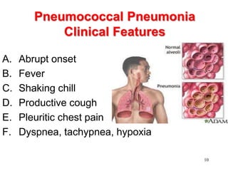 PNEUMOCOCCUS | PPT