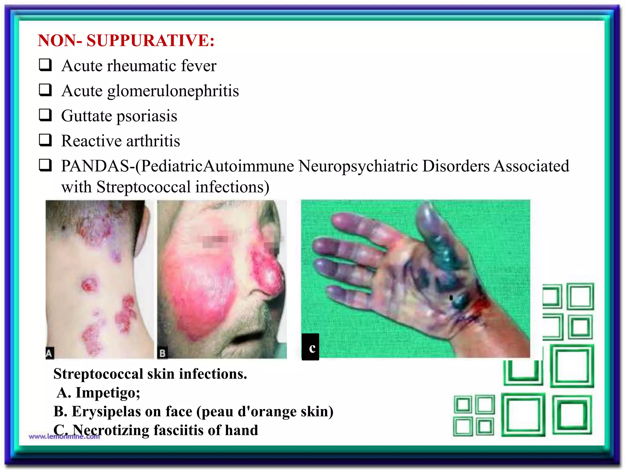 NON- SUPPURATIVE:
 Acute rheumatic fever
 Acute glomerulonephritis
 Guttate psoriasis
 Reactive arthritis
 PANDAS-(PediatricAutoimmune Neuropsychiatric Disorders Associated
with Streptococcal infections)
c
Streptococcal skin infections.
A. Impetigo;
B. Erysipelas on face (peau d'orange skin)
C. Necrotizing fasciitis of hand
 