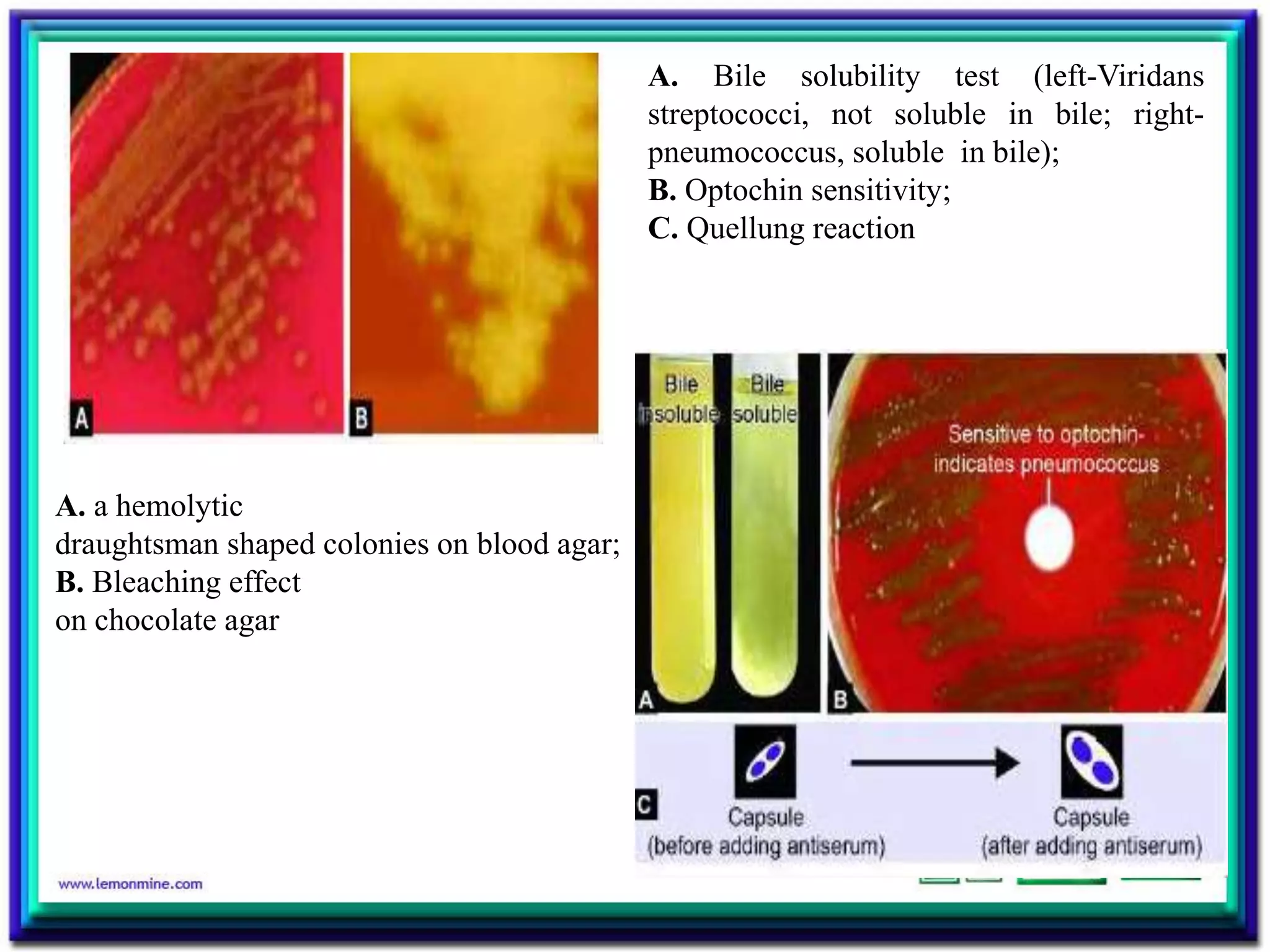 A. a hemolytic
draughtsman shaped colonies on blood agar;
B. Bleaching effect
on chocolate agar
A. Bile solubility test (left-Viridans
streptococci, not soluble in bile; right-
pneumococcus, soluble in bile);
B. Optochin sensitivity;
C. Quellung reaction
 