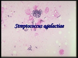 Streptococcus  agalactiae 