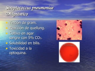 Streptococcus pneumoniae Diagnóstico <ul><li>Tinción de gram. </li></ul><ul><li>Reacción de quellung. </li></ul><ul><li>Cu...