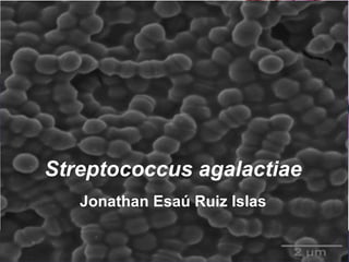 Streptococcus agalactiae Jonathan Esaú Ruiz Islas 