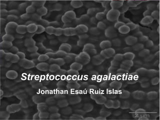 Streptococcus agalactiae Jonathan Esaú Ruiz Islas 