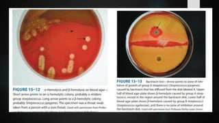Streptococcus Agalactiae Bacteria Microbiology Lecture