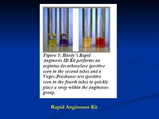 Rapid Anginosus Kit 
