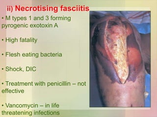 ii) Necrotising fasciitis
• M types 1 and 3 forming
pyrogenic exotoxin A
• High fatality
• Flesh eating bacteria
• Shock, DIC
• Treatment with penicillin – not
effective
• Vancomycin – in life
threatening infections
 