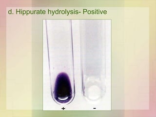d. Hippurate hydrolysis- Positive
 