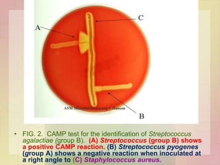 • FIG. 2. CAMP test for the identification of Streptococcus
agalactiae (group B). (A) Streptococcus (group B) shows
a positive CAMP reaction. (B) Streptococcus pyogenes
(group A) shows a negative reaction when inoculated at
a right angle to (C) Staphylococcus aureus.
 