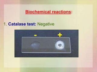 Biochemical reactions:
1. Catalase test: Negative
 