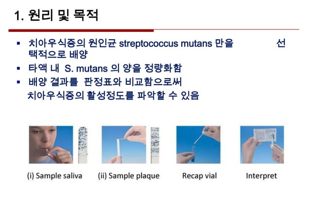 정설화 Streptococcus mutans 균 검사 | PPT