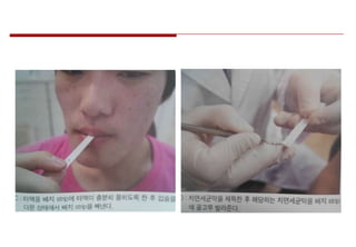 정설화 Streptococcus mutans 균 검사 | PPTX