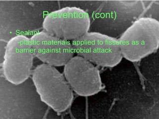 Prevention (cont) <ul><li>Sealant  </li></ul><ul><li>-plastic materials applied to fissures as a barrier against microbial...