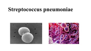 Streptococcus pneumoniae
 