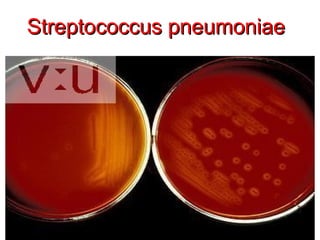 Streptococcus pneumoniae




11/26/12   Dr.T.V.Rao MD   17
 