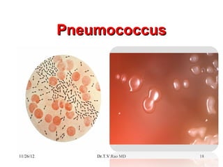 Pneumococcus




11/26/12       Dr.T.V.Rao MD   18
 