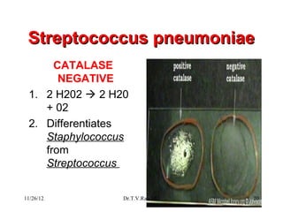 Streptococcus pneumoniae
      CATALASE
       NEGATIVE
 1. 2 H202  2 H20
    + 02
 2. Differentiates
    Staphylococcus
    from
    Streptococcus


11/26/12         Dr.T.V.Rao MD   20
 