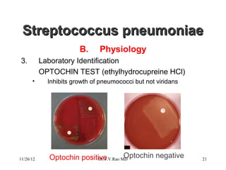 Streptococcus pneumoniae
                        B.     Physiology
3.         Laboratory Identification
           OPTOCHIN TEST (ethylhydrocupreine HCl)
      •      Inhibits growth of pneumococci but not viridans




11/26/12     Optochin positive          Optochin negative
                            Dr.T.V.Rao MD                      21
 