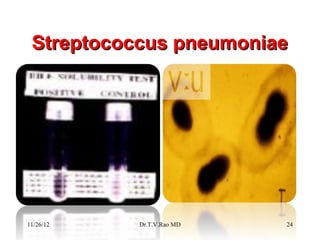 Streptococcus pneumoniae




11/26/12   Dr.T.V.Rao MD   24
 