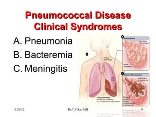Pneumococcal Disease
     Clinical Syndromes
A. Pneumonia
B. Bacteremia
C. Meningitis



11/26/12   Dr.T.V.Rao MD   9
 