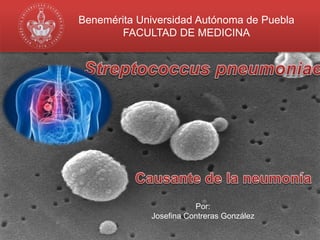 Benemérita Universidad Autónoma de Puebla 
FACULTAD DE MEDICINA 
Por: 
Josefina Contreras González 
 