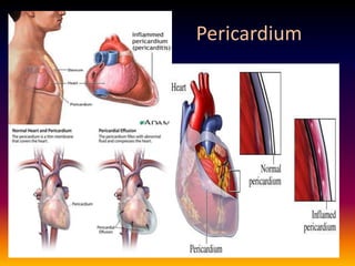 Pericardium
 