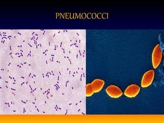 PNEUMOCOCCI
 