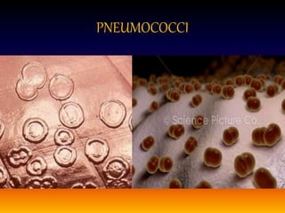 PNEUMOCOCCI
 