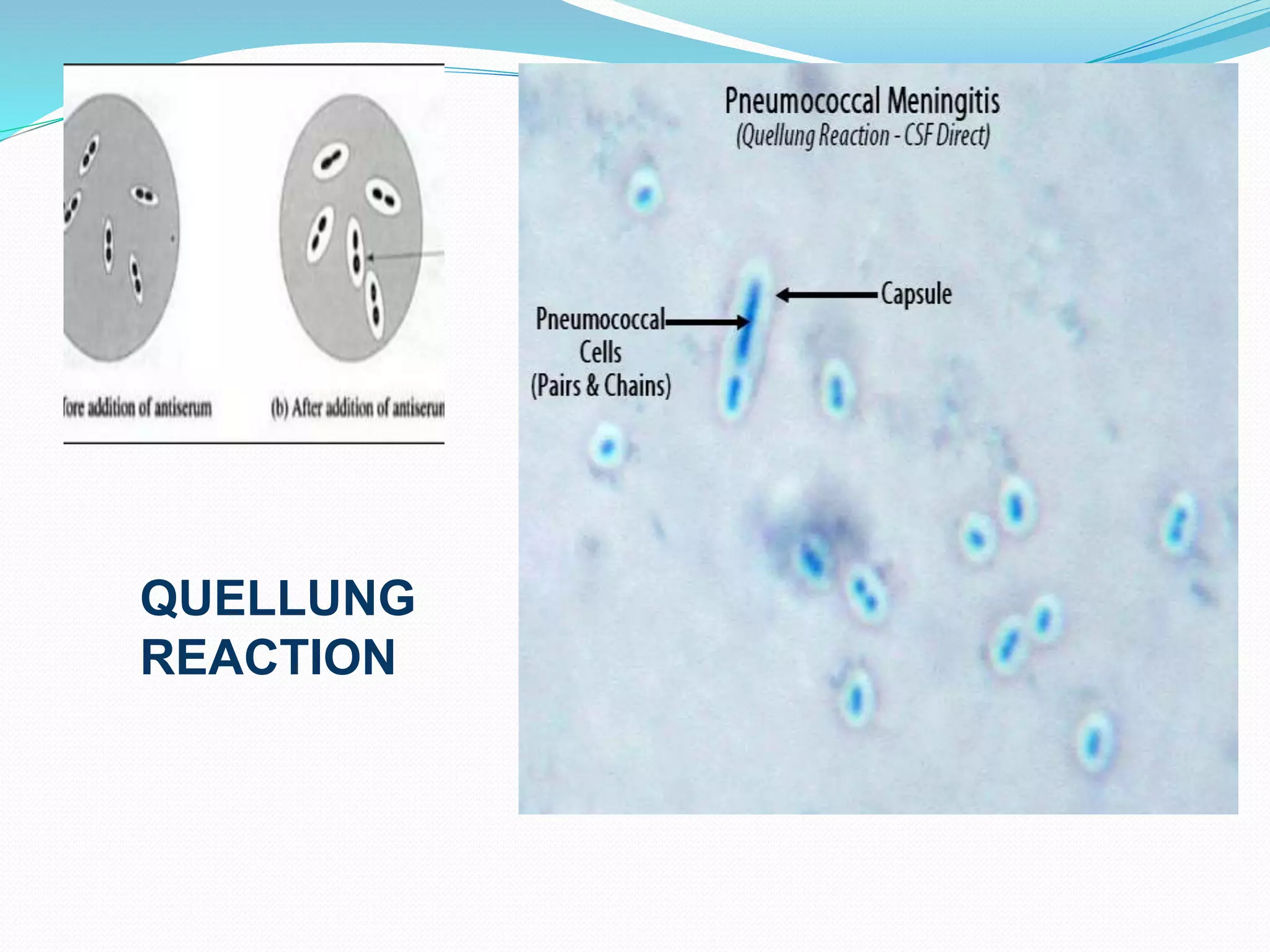 Streptococcus pneumoniae | PPTX