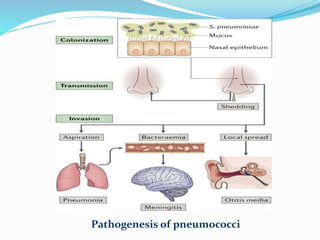 Pathogenesis of pneumococci
 