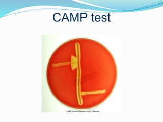 CAMP test
 