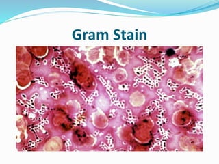 Gram Stain
 