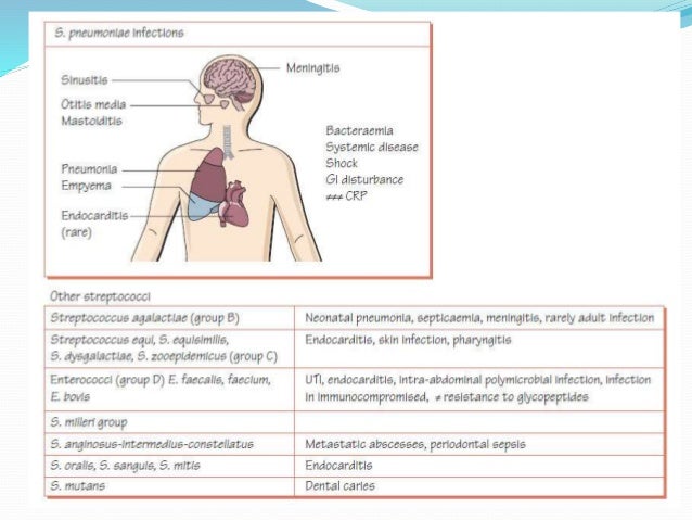 how to diagnose streptococcus pneumoniae